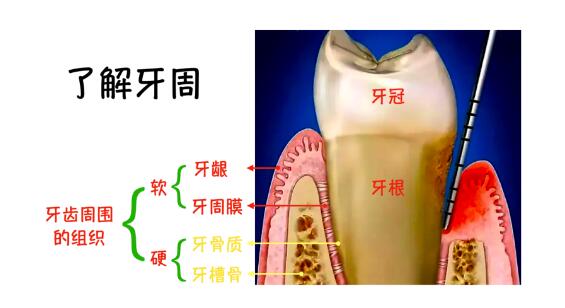 牙周炎