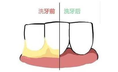 徐州慈爱口腔价格表(费用)新一版暴光附韩国种植体案例